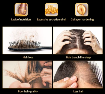 OMY LADY Plaukų Augimą Purškimo Esminius Serumas Plaukų Atauga, Alyva, Stabdžių Plaukų Slinkimas Skysčio Vyrų, Moterų Sausų Plaukų atgaivinimo Remontas