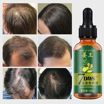 LAIKOU Imbieras Plaukų Augimo Esmė 7 Dienas Germinaciniai Plaukų Augimo Serumas Esmė Aliejus, Plaukų Slinkimas Gydymo Augimo Plaukų Vyrams, Moterims