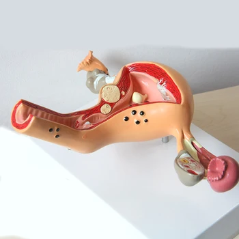 Medicinos Mokslo Priedai Patologinių Gimdos, Kiaušidžių Anatomijos Modelis Anatomija Skerspjūvio Medicinos mokymo reikmenys