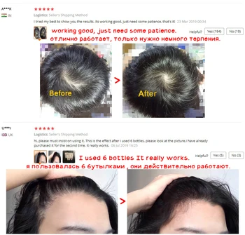 OMY LADY Plaukų Augimą Purškimo Esminius Serumas Plaukų Atauga, Alyva, Stabdžių Plaukų Slinkimas Skysčio Vyrų, Moterų Sausų Plaukų atgaivinimo Remontas