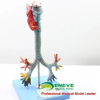 ENOVO Žmogaus gerklų ir tracheobronchial medžio modelį gerklų anatomijos modelis plaučių broncholaryngoscope demonstravimo